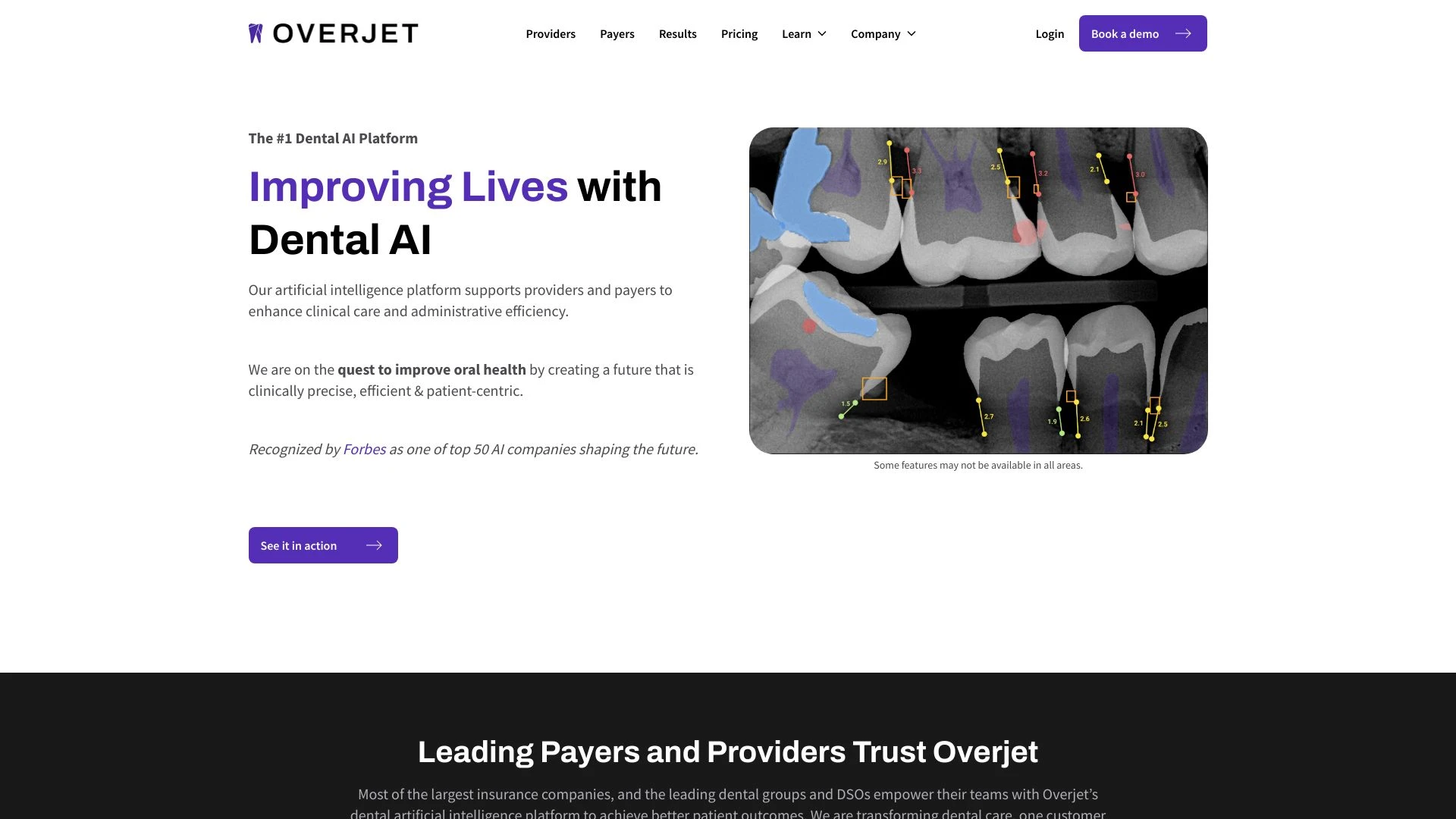 Overjet AI website preview